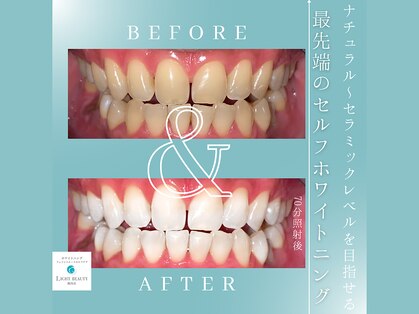 ライトビューティー 関内店(LIGHT BEAUTY)の写真