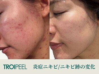 ボーテスキンクリニック