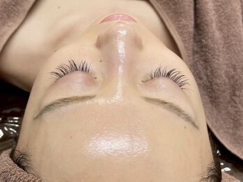 アルムダアクア 天王寺店(Aleumda AQUA)の写真/【天王寺駅チカ】著名人も御用達!剥けない&ダウンタイムなし♪今話題の【REVIハーブピーリング】で艶肌へ!!