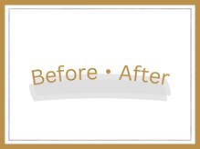 ゼン骨盤整体院(ZEN骨盤整体院)/ビフォーアフター