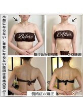 ソウ バイ ソウ(So by 蒼)/肋骨と肩甲骨は、密接な関係が。