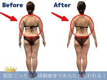 ワクワクボディクリニック 鶴ヶ峰店(WAKUWAKU BODY CLINIC)の雰囲気（ハイパーナイフで痩身ダイエット＆たるみ改善！ブライダルも◎）