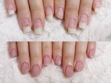 グラシナ 鳥丸店/ナチュラルカラーで可愛く矯正