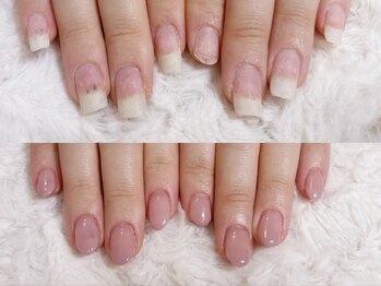 グラシナ 鳥丸店/ナチュラルカラーで可愛く矯正