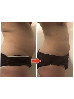 ボディラインを整えたい