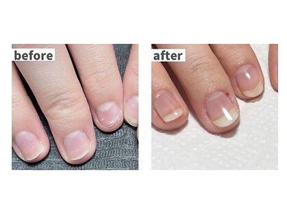 ミュウネイル 宜野湾(Myu nail)の写真