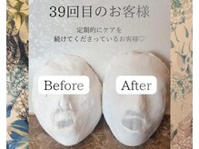 カンコルギセラピー 広島幟町店(KAN)の雰囲気（浮腫み方が変わったのを実感いただいております(^^)）