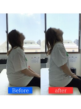 ナオル整体 神戸住吉院(NAORU整体)/30代女性【肩こり・頭痛】