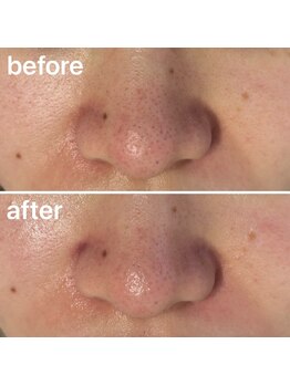 エイミー(Amy)/Before&After