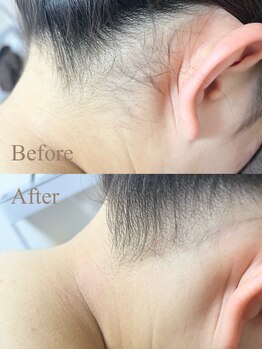 ルアーナ(LUANA)/アップスタイルに自信!