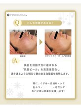 ココ 2号店(CoCo)/ホワイトスノーピール