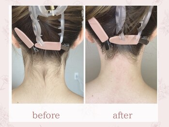 エリィ ワックス(erii wax)/《うなじ》でこんなに変わる!