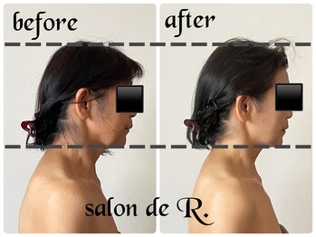 サロン ド アール(salon de R.)/【変わる骨美容・60代】
