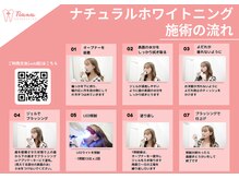 ティアナ 徳島店(Tiana)/ホワイトニングの流れ
