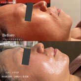 メイリリーブラン(MayLily-Blanc)