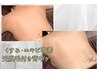 *先着5名*くすみ&ニキビ改善 脱毛付き背中ケアモニター価格¥7,000×3回セット