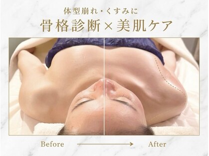 アネラ(Anela)の写真