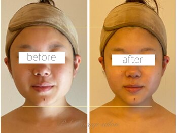 パル コルギサロン(Pal. Korugi salon)/コルギビフォーアフター