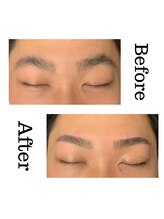 ヴィーナス アイビューティー(VENUS Eye Beauty)/ビフォー/アフター