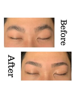 ヴィーナス アイビューティー(VENUS Eye Beauty)/ビフォー/アフター