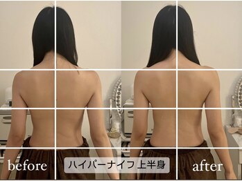 ラコル 京橋店(lacol)/【ハイパーナイフ上半身】