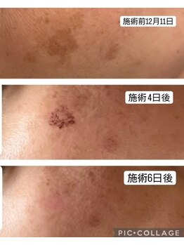 ベルジェ(Bellje)/*最新光フォト*