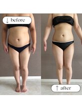 トータルビューティーサロンリア(Li'a)/ビフォー＆アフター