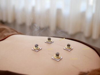 ノア鍼灸院 温灸堂(NOA鍼灸院)の写真/これまで鍼で満足されなかった方!丁寧なカウンセリング×施術で満足度◎是非当店にご相談ください。