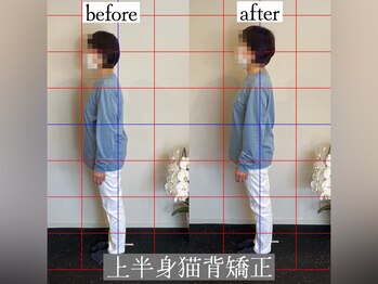 りかり 明石大久保院/猫背改善で姿勢年齢マイナス10歳