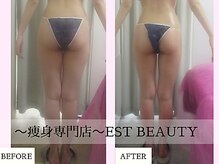 エストビューティー 池袋店(EST BEAUTY)/結果の出る技術【池袋/痩身】