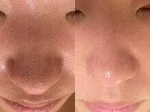 アエオボンヌール(A.E.O BONHEUR)/