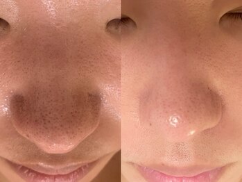 アエオボンヌール(A.E.O BONHEUR)/