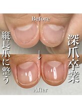 リリー/こんなに変化が！