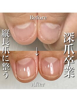 リリー/こんなに変化が！