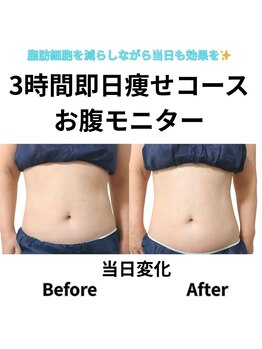ホワイトビューティーラボ(White Beauty Lab)/3時間即日痩せモニター