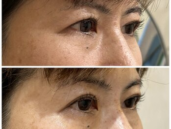 ドクターボディクリスタル(Dr.Body Crystal)/40代後半