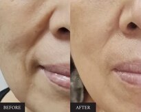 トータルエステサロン ポイント(POINT)