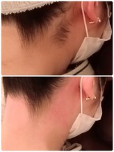 エン(en.)/BeforeAfter写真37