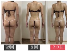 ウィズルーチェ つくばみどりの店(with luce)の雰囲気（全身痩身エステ120分コース20回3ヶ月【30代産後】）