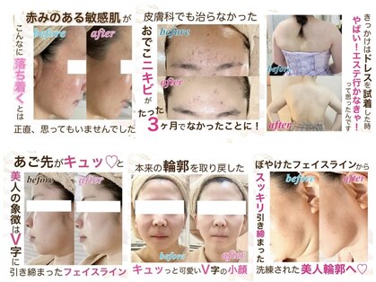 ソワンドビジュー(soin de bijew)の写真