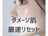 【9月限定】夏に受けた紫外線ダメージ肌に集中美白ケア¥20900→初回¥5500