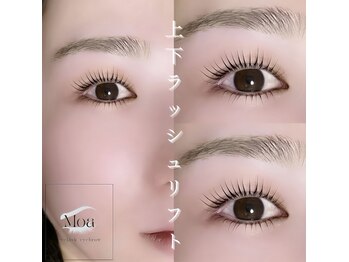 モア(Moa)/上下ラッシュリフト