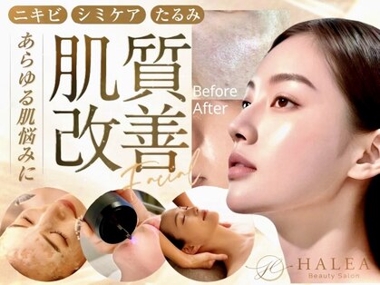 ハレア(HALEA)の写真