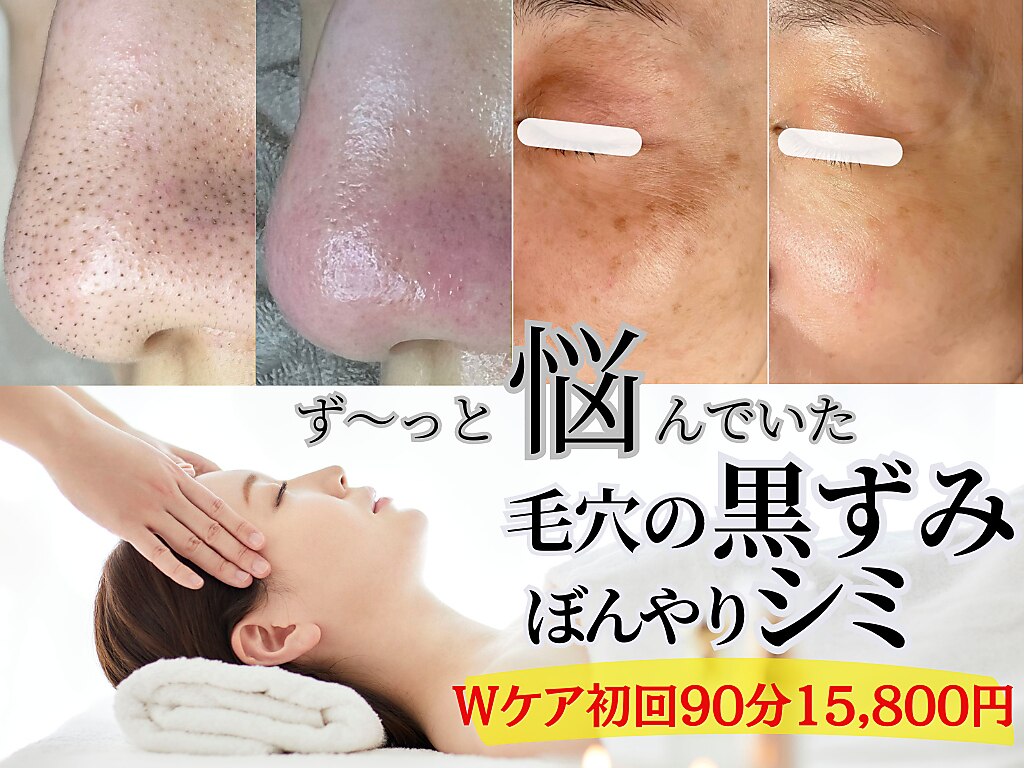 名古屋市昭和区で毛穴洗浄・毛穴吸引が人気のエステサロン