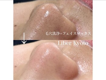 エステティック リベル キョウト 京都駅前店(Esthetic Liber Kyoto)/フェイスワックス脱毛