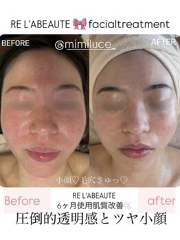 ミミルーチェ 中目黒(mimiluce)/リアボーテで作るオトナ肌革命