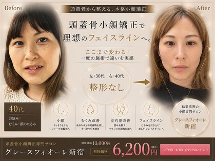 グレースフィオーレ 新宿店 (gracefiore)の写真