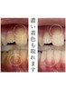 【全額返金制度あり】プロフェッショナルコース　1回/¥8,000