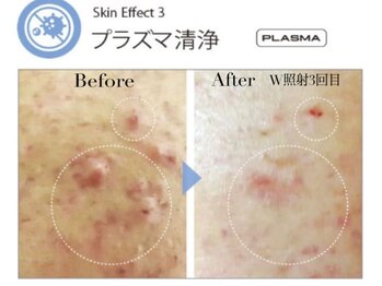 ルブラン(Lu'Bulan)/【プラズマシャワー取扱店】