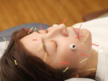 すわ鍼灸整骨院/美容鍼灸でリラックス♪